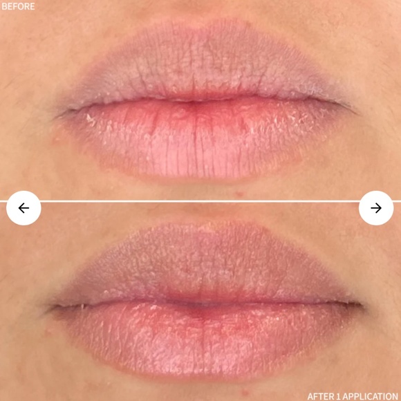 ResuceMD Restorative Lip Treatment Hydration + Volume Enhancement NEW BOX - Picture 4 of 5